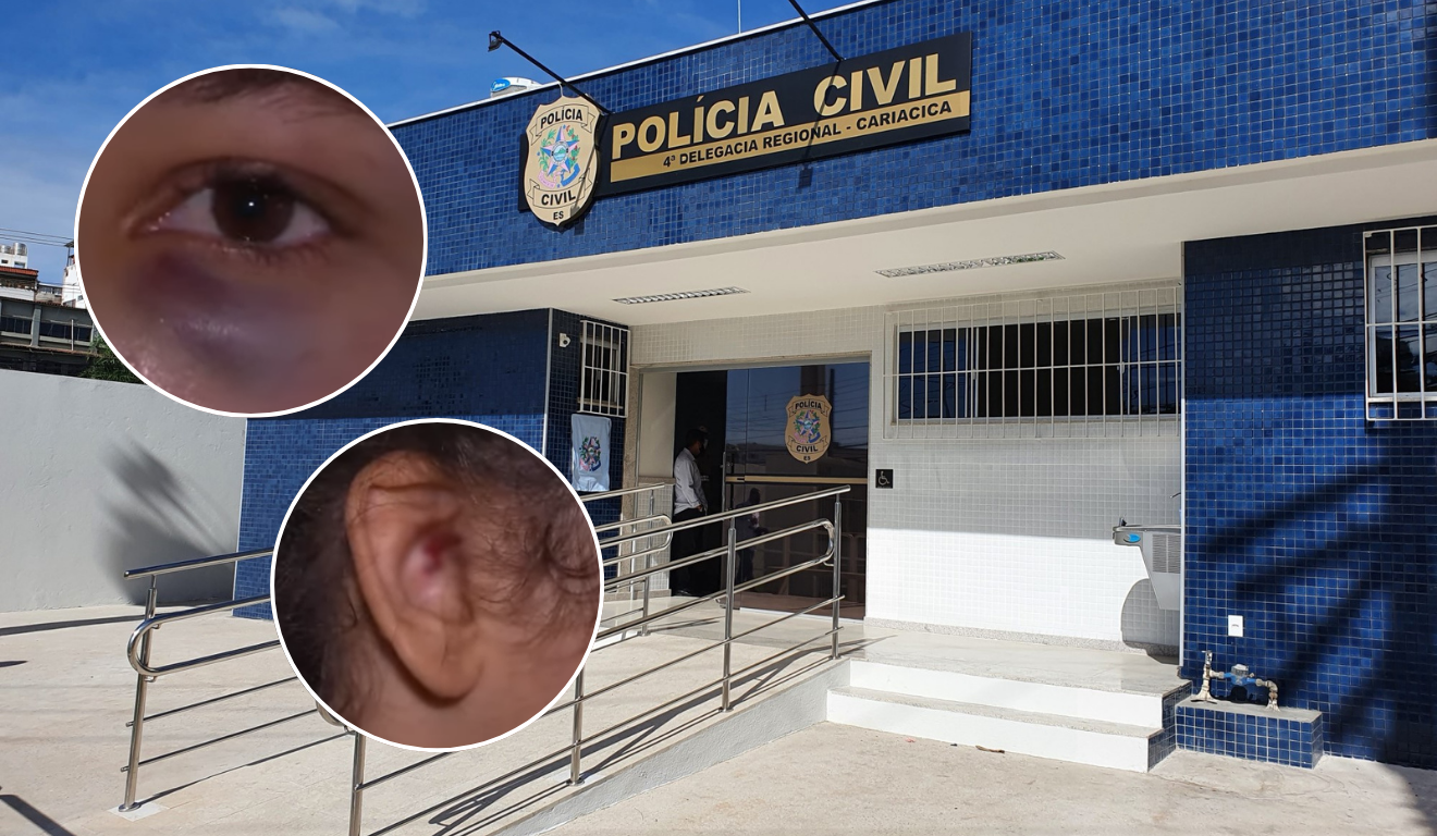 Mulher-gravida-e-agredida-em-Vila-Velha-Foto-TV-Vitoria-Reproducao-.png